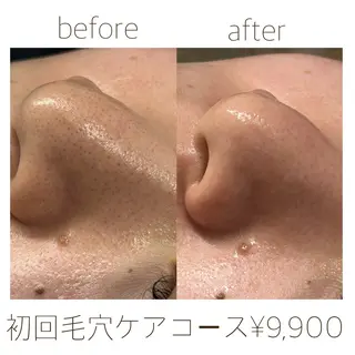 田辺🌿毛穴ケア サロンリテルナのエステ・リラクイメージ