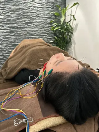 小顔矯/美容鍼/鍼灸 BeauJuのその他イメージ