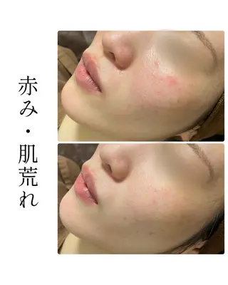 ハーブピーリング専門 BIOEL横浜のエステ・リラクイメージ