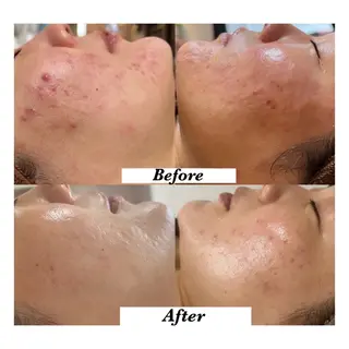 𝐌𝐚𝐜𝐡𝐞 𝐛𝐲 𝐌𝐚𝐲𝐮所属・ハーブピーリング🌿 𝑴𝒂𝒚𝒖のエステ・リラクイメージ