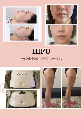 リンパドレナージュ＆ 産前産後サロンSheのエステ・リラクイメージ