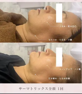 🌟看護師が施術🪄 ナスサロ/狩野のエステ・リラクイメージ