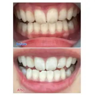 M渋谷 ホワイトニングのエステ・リラクイメージ