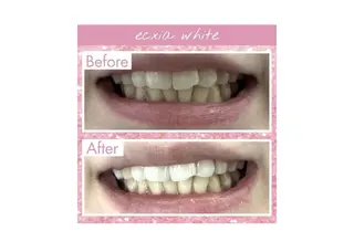 セルフホワイトニング エクシア大阪梅田店のその他イメージ