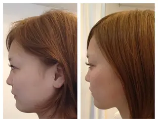 小顔・姿勢矯正専門 〜Re・birth〜のその他イメージ