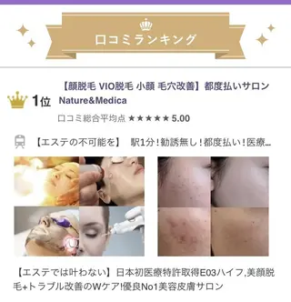顔脱毛&毛穴&ニキビ 優良№1♪ヒロコ♪のエステ・リラクイメージ