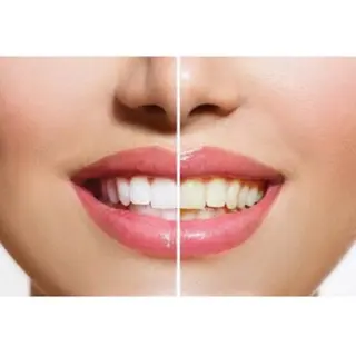 ペルラメディカル ホワイトニング名古屋のその他イメージ