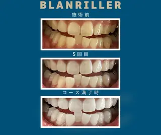 BLANRILLER所属・ホワイトニングサロン ブランリエ阿倍野店のその他イメージ