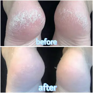 全身脱毛／リラク Lokahiのエステ・リラクイメージ