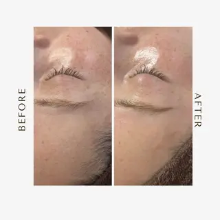 1st｜フェイシャル エステ専門店のエステ・リラクイメージ