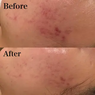 seika🍒 ハリラウンジ梅田のエステ・リラクイメージ