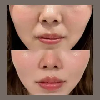 愛維美水光美肌専門店所属・愛維美水光美肌専門店 メンズレディースokのエステ・リラクイメージ