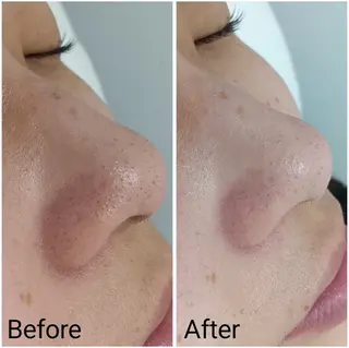 シミケア専門店 HAQUAのエステ・リラクイメージ