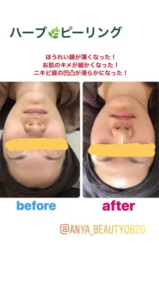 Anya Beautyのエステ・リラクイメージ