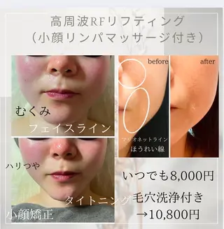 OUKA脱毛 毛穴ケアフェイシャルのエステ・リラクイメージ