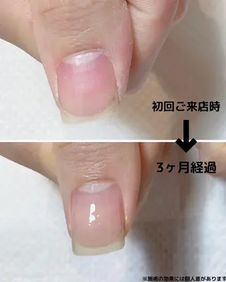 ネイル 自爪育成専門店 Kapilinaのネイルデザイン