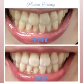 プラティーヌ ボーテのその他イメージ