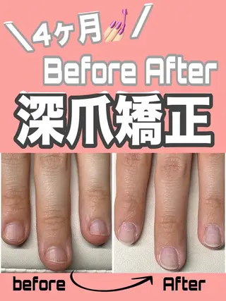 ネイル nail salon petillantのネイルデザイン