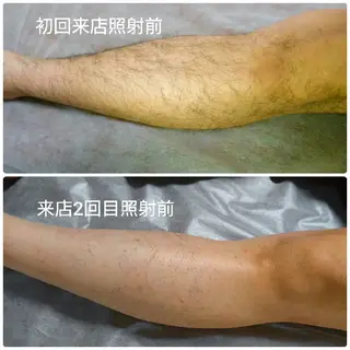 Iryアイリー所属・Iry アイリーのエステ・リラクイメージ