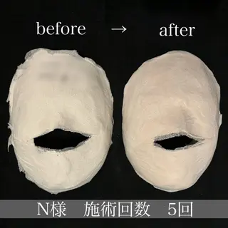 小顔サロン Moanaのエステ・リラクイメージ