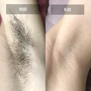 美容＆脱毛サロン 金沢文庫のエステ・リラクイメージ