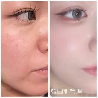 Raviy 【痩身・韓国肌管理】のエステ・リラクイメージ