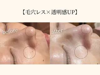 小顔矯正×毛穴サロン DRRAMSPA町田のエステ・リラクイメージ