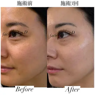 facial salon D 吉沢のエステ・リラクイメージ