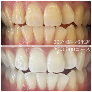 ホワイトニングルーム 横浜店のその他イメージ