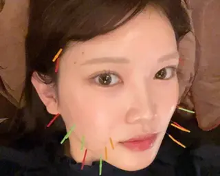 Acupuncture  salon LINOA リノア鍼灸院所属・LINOAヘッドスパ 小顔ケア/逆子ケアのエステ・リラクイメージ