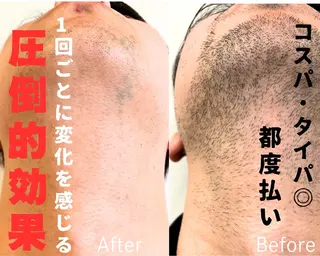 メンズ ELEGANCE所属・メンズ脱毛サロン BRIGHTのエステ・リラクイメージ