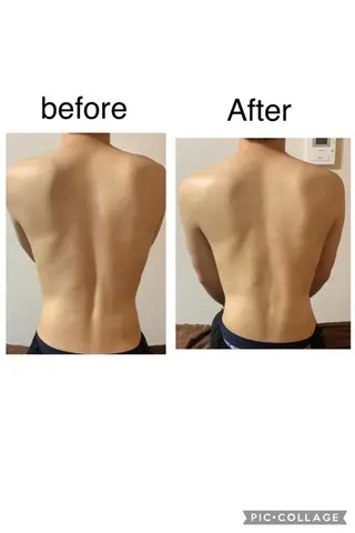 朝重い人専用 肩甲骨調整のエステ・リラクイメージ