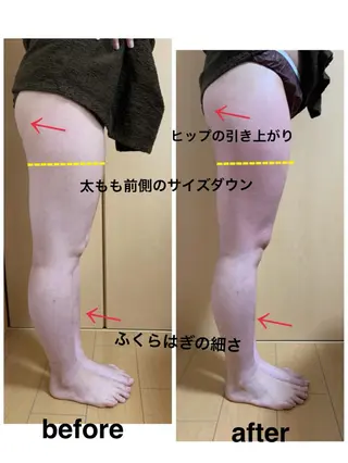 痩身/脱毛/ネイル HARUKAのエステ・リラクイメージ