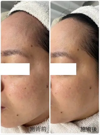 メンズ えだ すがこのエステ・リラクイメージ