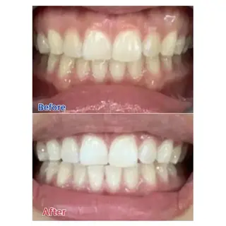 M渋谷 ホワイトニングのエステ・リラクイメージ