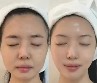 ネイル aliaハーブ水光店 エステティシャン募集のエステ・リラクイメージ