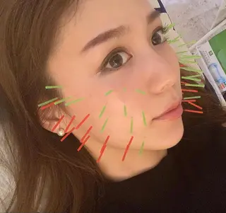 鍼灸 Refineのその他イメージ