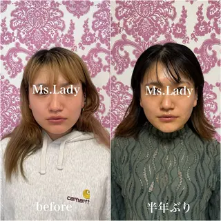 オンダリフト小顔・ ワックス脱毛×光脱毛のエステ・リラクイメージ