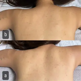 217 ホワイトニングルームのエステ・リラクイメージ