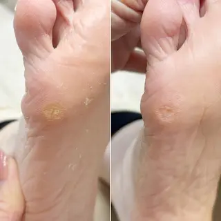 ネイル 深爪・巻き爪 専門サンセリテのネイルデザイン