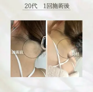 LED脱毛サロン 💐ayaのエステ・リラクイメージ