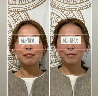 あだち整体エステ 首肩背中のゆるめぐのエステ・リラクイメージ