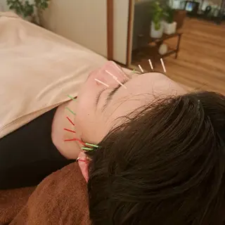 鍼灸サロンmiyabi所属・美容鍼×エステ　鍼灸 サロンmiyabiのエステ・リラクイメージ