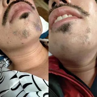 muscle＆esthe jonny's beauty所属・jonny's beautyのエステ・リラクイメージ