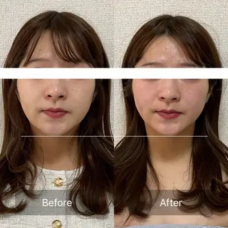 小顔×肌質改善 《お顔の印象》のエステ・リラクイメージ