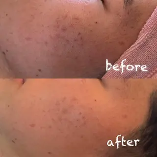 美肌蘇生カウンセラー 横山りえのエステ・リラクイメージ