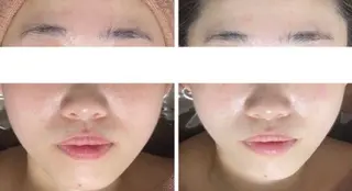 中目黒ハーブピーリン グ🌿ララピールのエステ・リラクイメージ