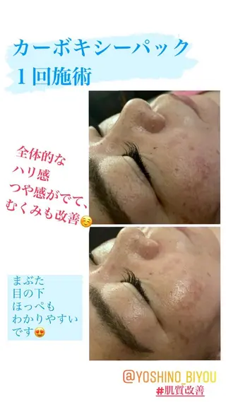 美容鍼灸サロン YOSHINOのエステ・リラクイメージ