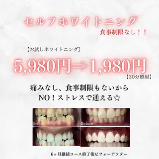 メンズ セルフホワイトニング WHITE福岡博多店のエステ・リラクイメージ