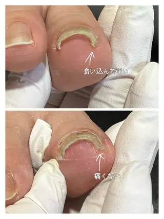 ネイル 巻き爪補正店 堺東店のネイルデザイン